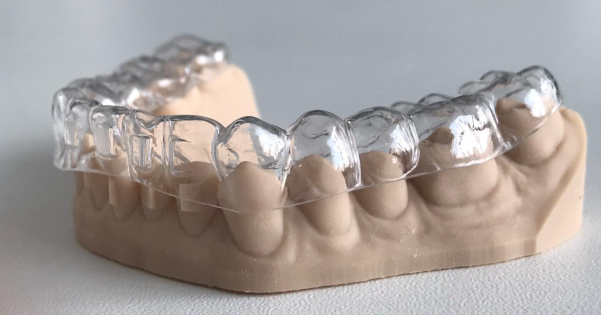 ¿Cuánto tiempo tarda el tratamiento con alineadores transparentes?